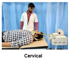 Cervical