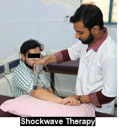 Shockwave Therapy