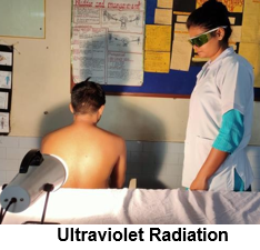 Ultraviolet Radiation