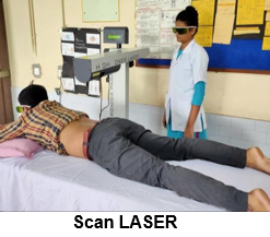 Scan LASER