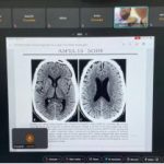 WORLD STROKE DAY 2025