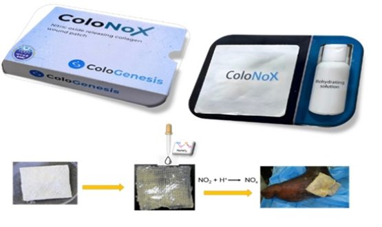 Launch of ColoNoX- Advanced Nitric Oxide-Releasing Wound Dressing for Diabetic Foot Ulcer (DFU)